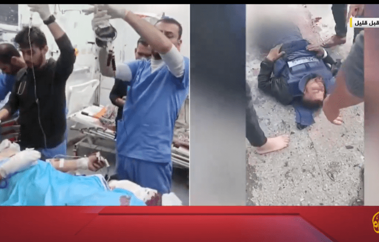 Al-Jazeera journalist Ismail Abu Omar receives treatment in a hospital (left) after being severely injured (right) by an Israeli drone strike while reporting near the city of Rafah in southern Gaza on February 13, 2024.